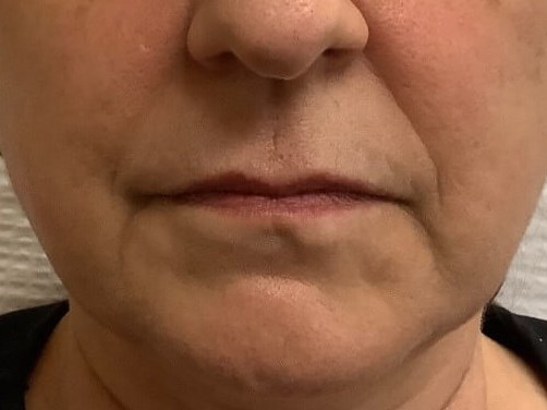 Before Image