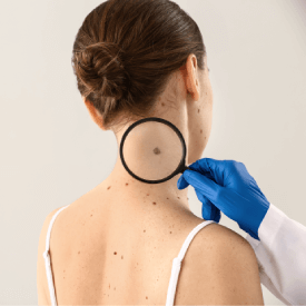 Surgical Dermatology