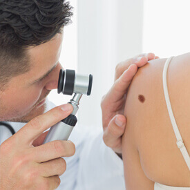 Skin Cancer